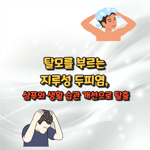 지루성 두피염, 샴푸와 생활 습관 개선