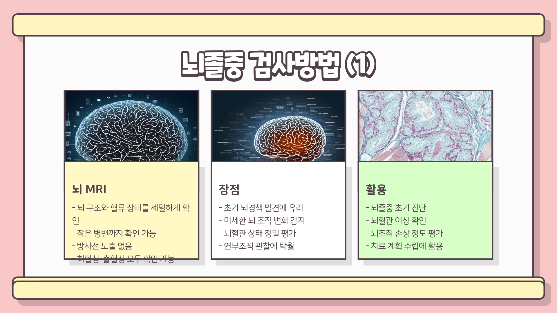 뇌졸중 전조증상 | 뇌졸중 예방법 | 뇌졸중 검사방법 완벽정리, 놓치면 돌이킬 수 없다