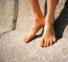 무좀 치료법 예방법 진단기준