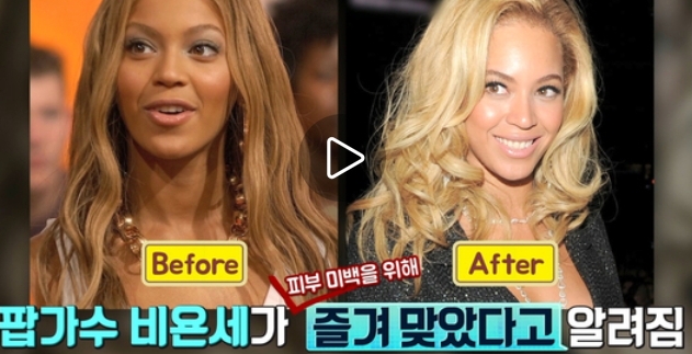 비욘세 주사