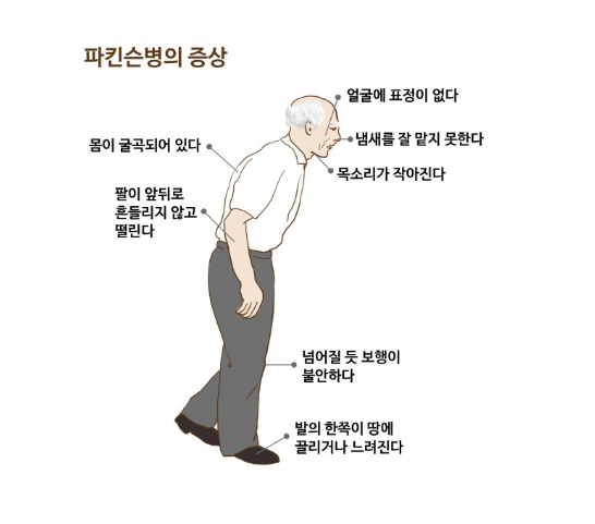 파킨슨병의 증상