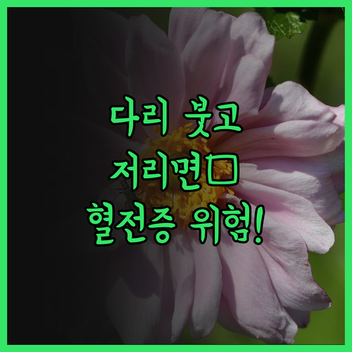 심부정맥 혈전증, 하지정맥류🚨서서 일