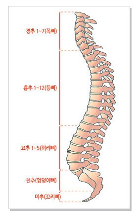 요추염좌