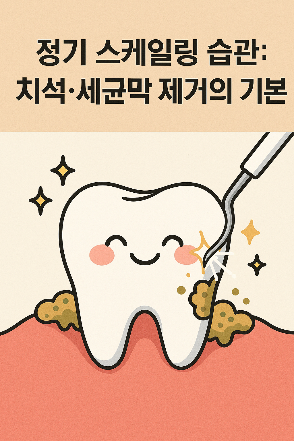 정기 스케일링 습관: 치석&middot;세균막 제거의 기본