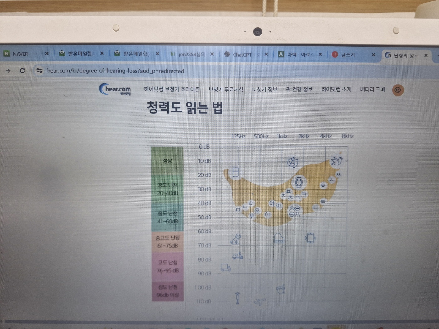 히어닷컴(Hear.com) 보청기 1달 무료 체험 후기 제10화/귀지 청소법