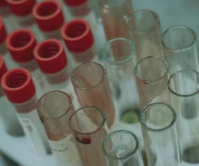 고지혈증 치료법 진단기준 예방