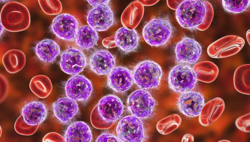 수면 부족이 염증을 유발