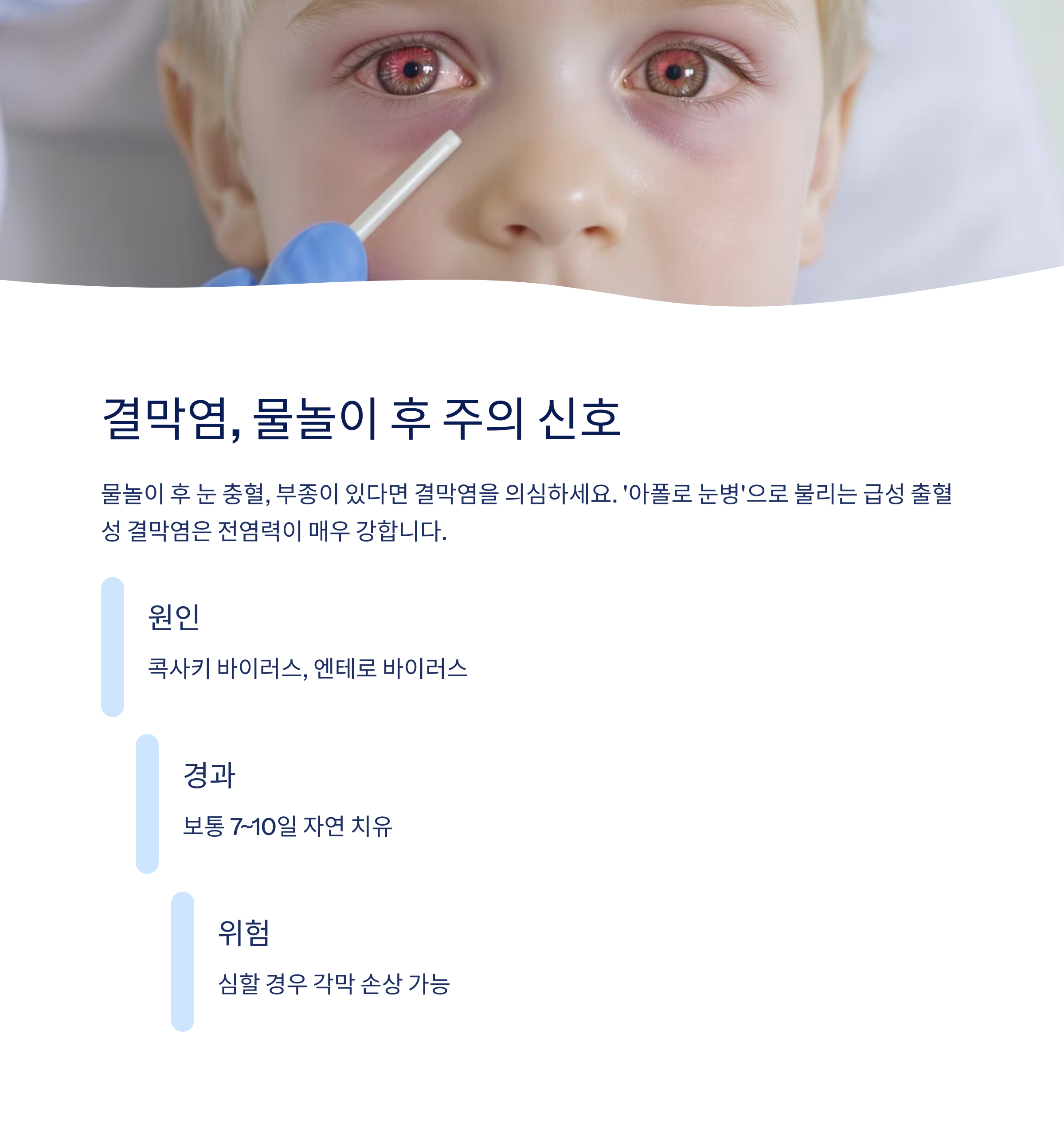결막염 물놀이 주의