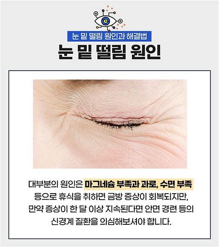 눈밑레이저