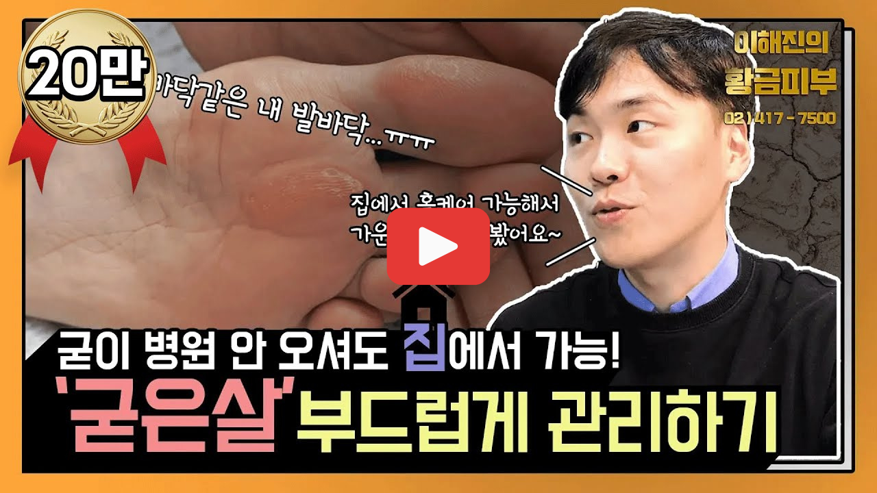 굳은살없애는방법