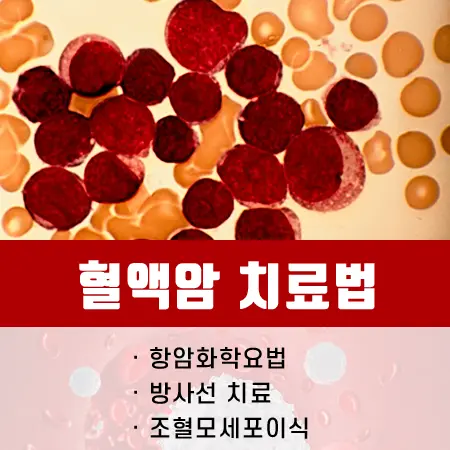 혈액암 치료법