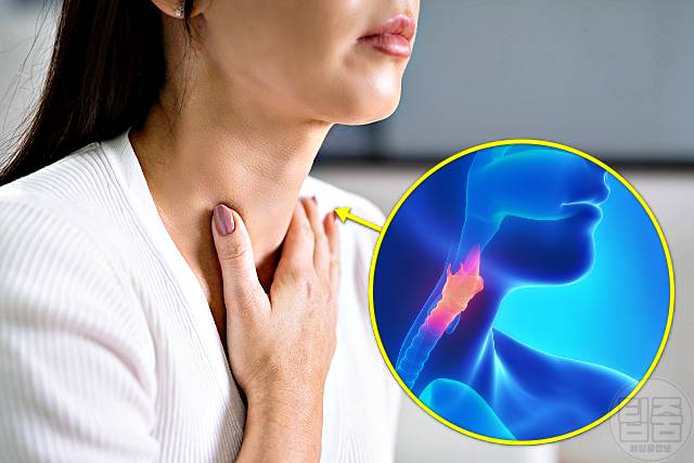 식도암 증상 식도암초기증상 목소리 갈라짐