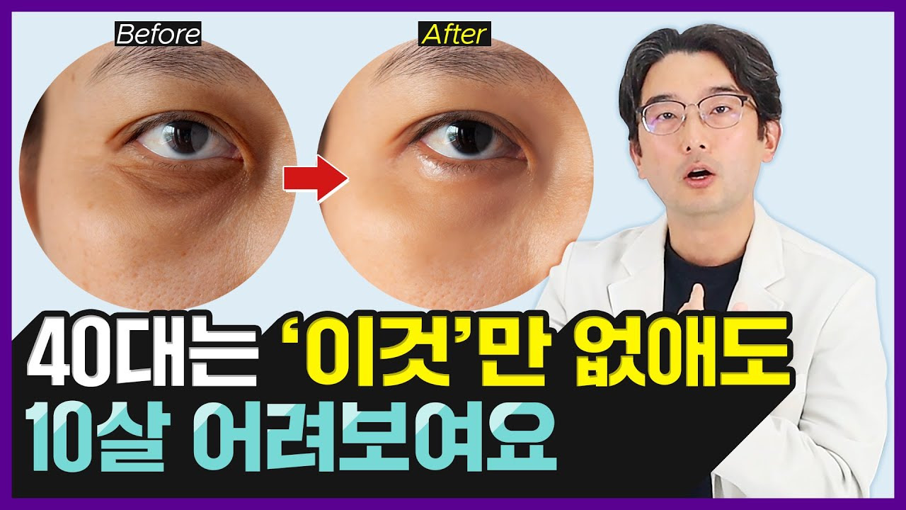 눈밑꺼짐- 없애는- 법-: 젊고