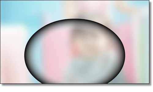 망막전막-유리체절제술-후기-과정-비용