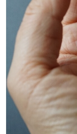 손가락수포대처법