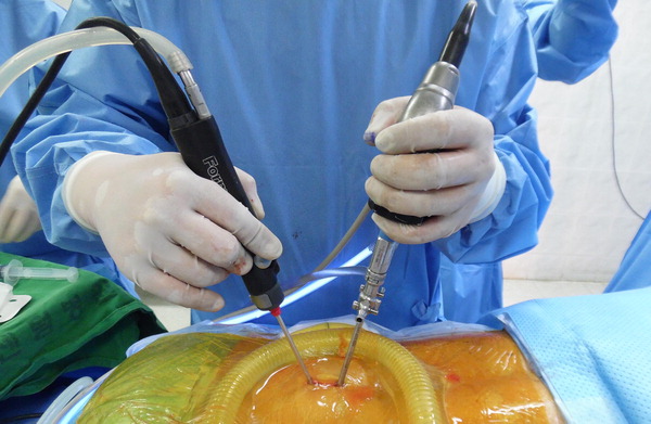 4개월 만에 다시 터진 디스크… 그날의 진짜 이야기