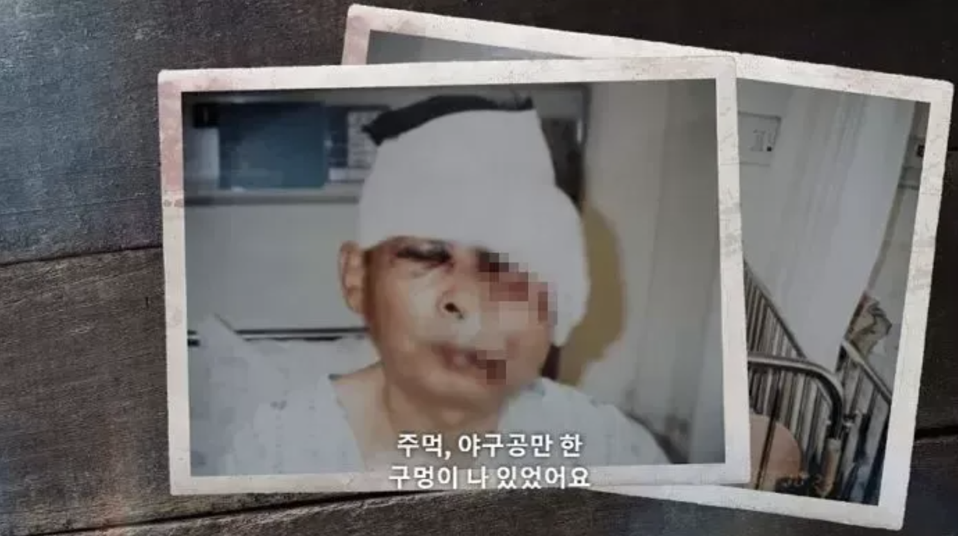 김도형 부친 테러 피해