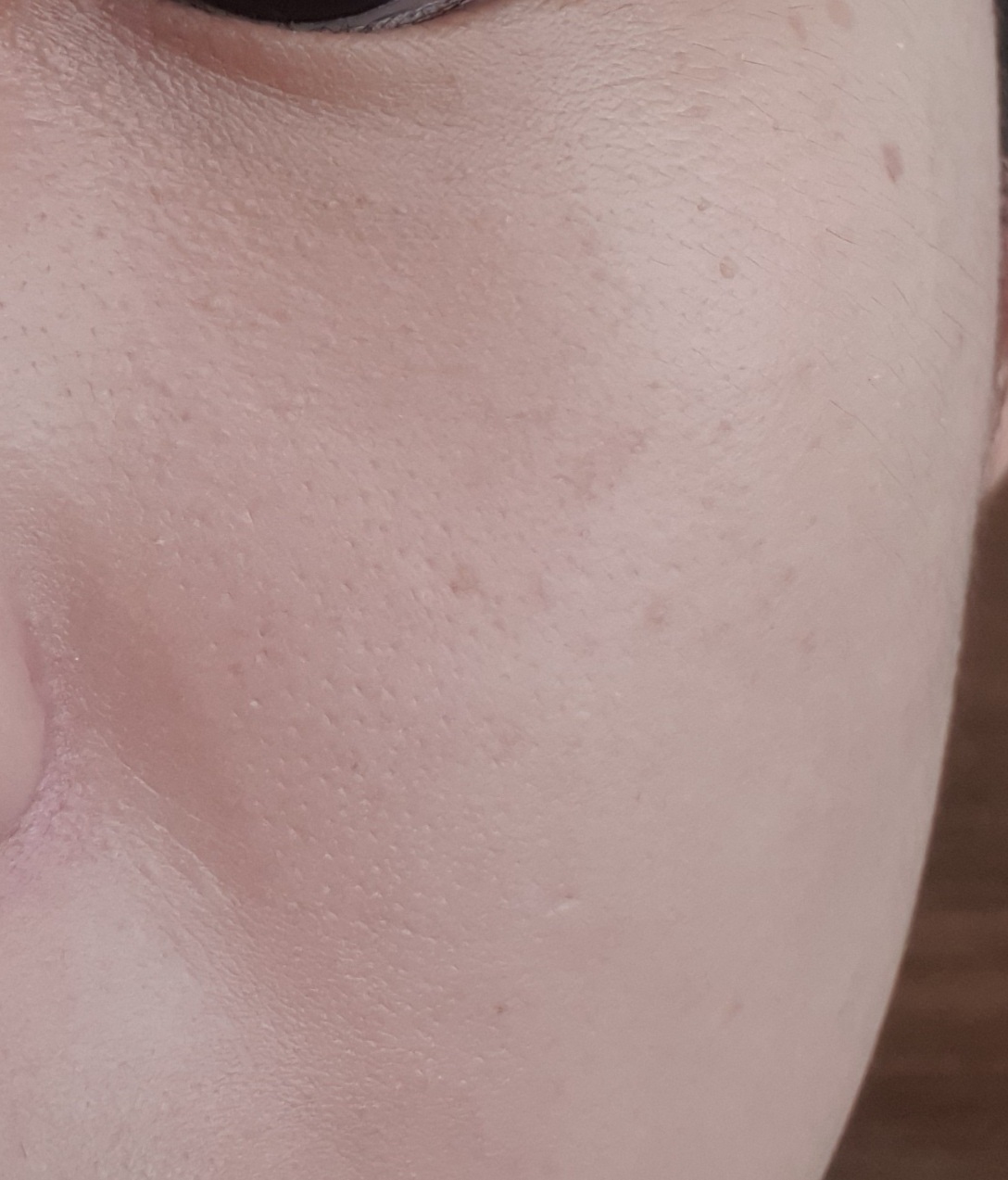 팩트 사용 직후(오른쪽 뺨)