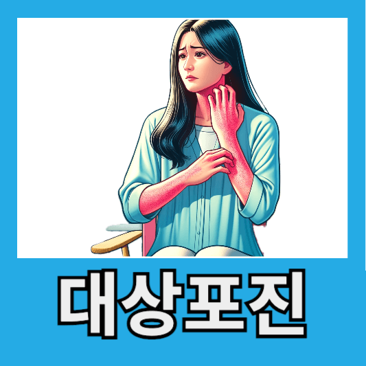 발진 수포 가려움증 대상포진 원인 증상 전염성 병원 치료