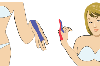 류마티스로 인한 손가락 통증의 테이핑요법