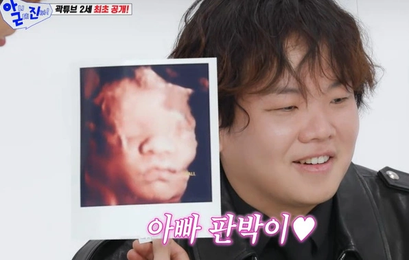 아기 초음파 사진