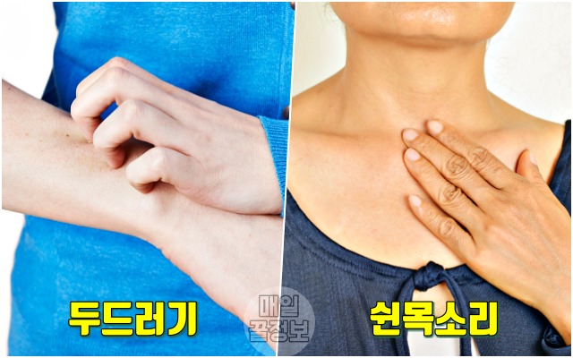 독감주사 맞고 열 감기 몸살 아픈 이유,팁줌