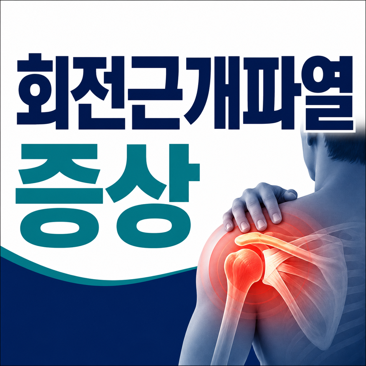 회전근개파열 증상