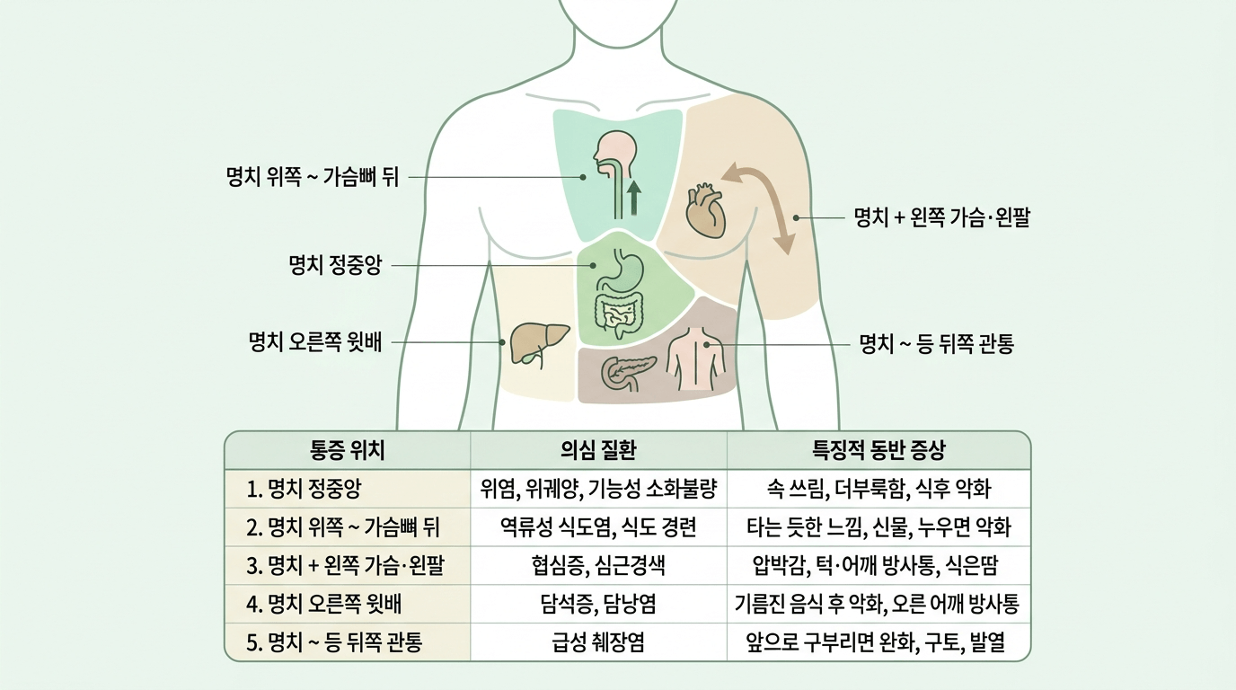 명치 통증 위치별 의심 질환 비교 인포그래픽