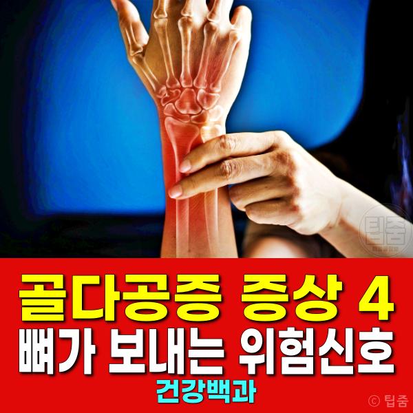 골다공증 증상 초기증상