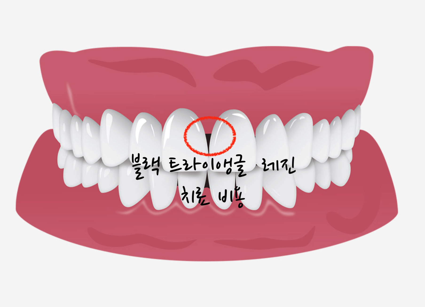 블랙 트라이앵글