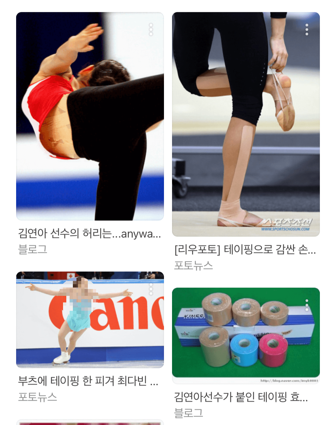 김연아선수-부상-테이핑한-모습