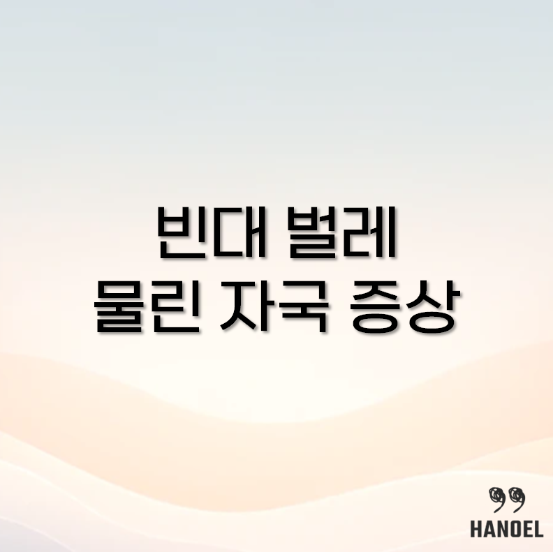 빈대