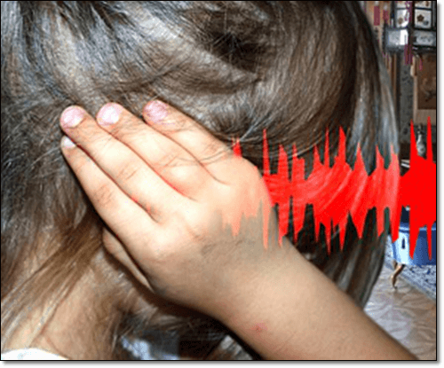 이관개방증 환자