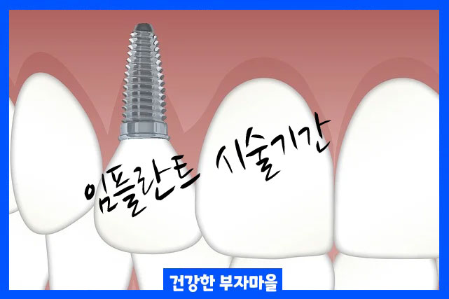 임플란트 시술기간 부작용 알아보기