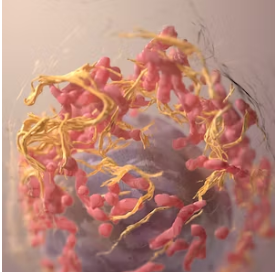 대장암-초기증상