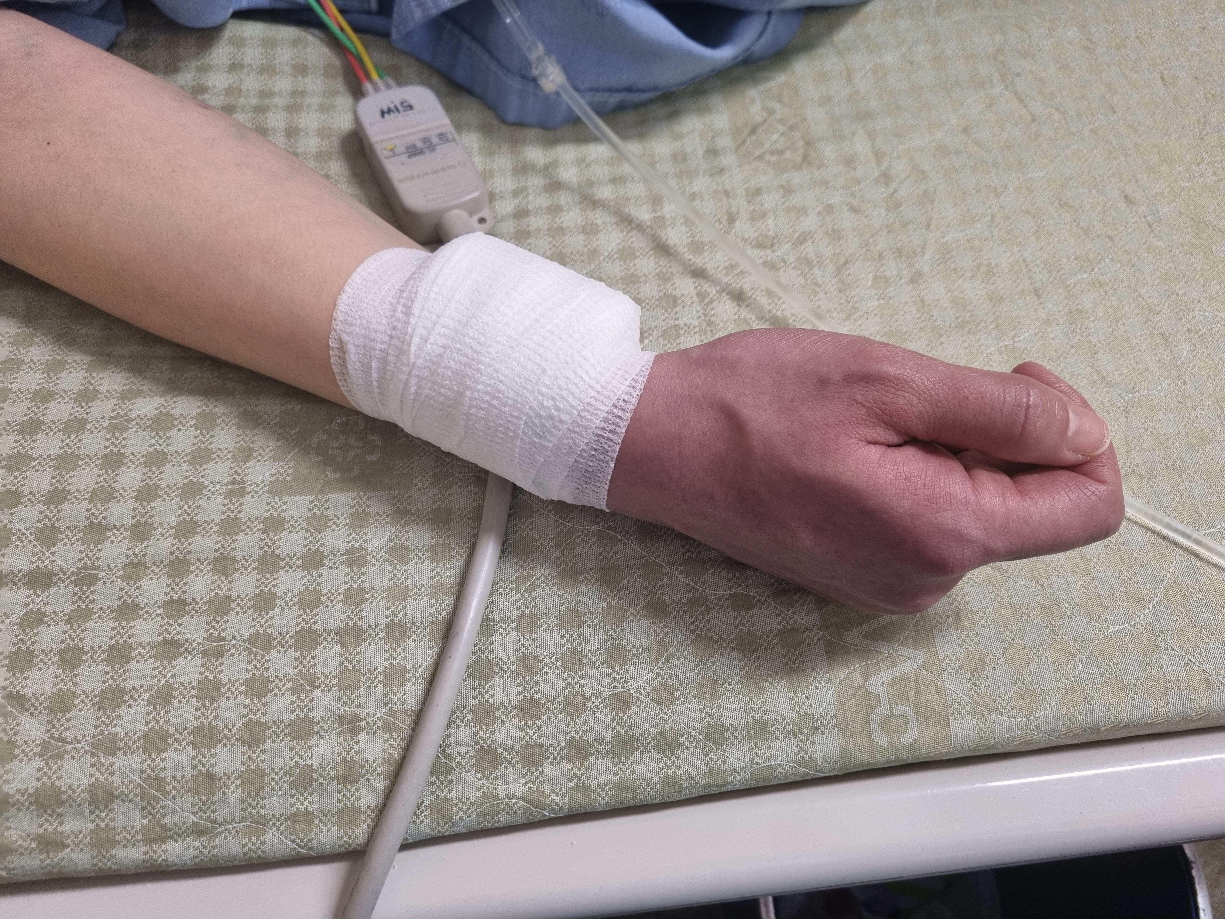 관상동맥 조영술 검사