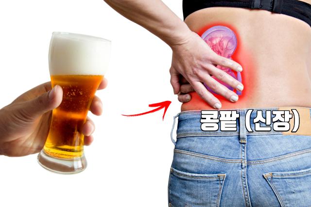 통풍 안좋은 음식 맥주 소주 위스키