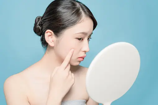 마데카솔 분말과 여드름