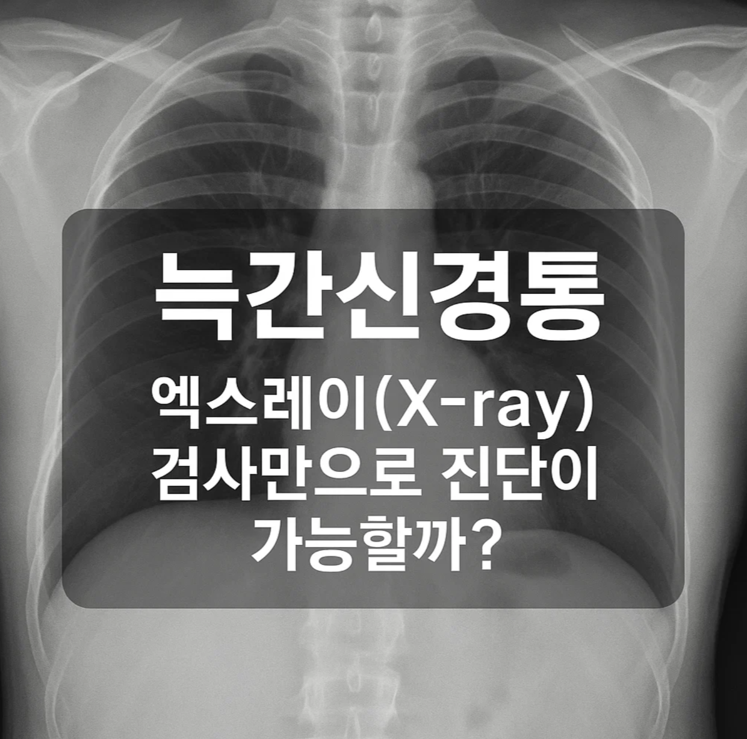 늑간신경통, 엑스레이(X-ray) 검사만으로 진단이 가능할까?