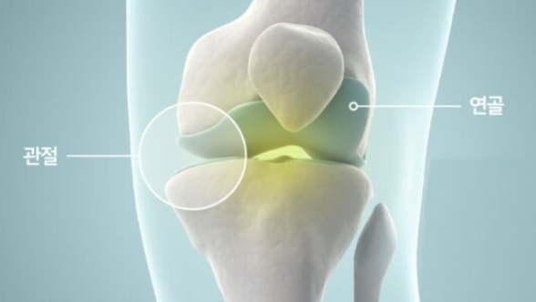 콘드로이친 효능