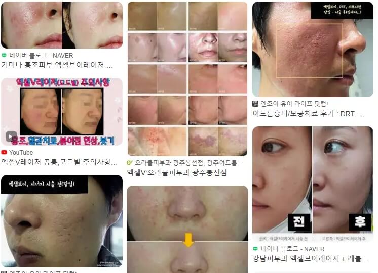 엑셀브이