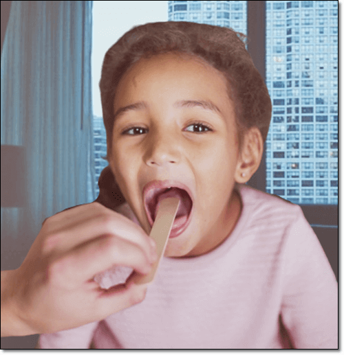 면역 기능 저하로 편도 염이 생긴 어린이