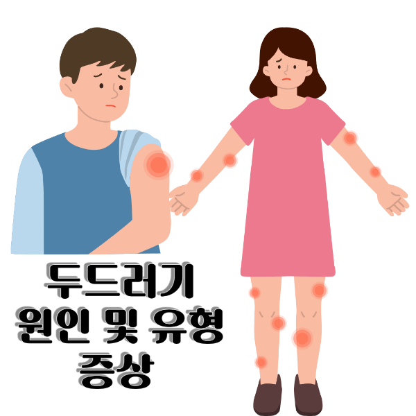 두드러기 이미지