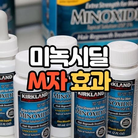 미녹시딜 M자 효과