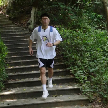 바르지오 무좀약으로 발톱 무좀 치료 기간 어느 정도 걸릴까?