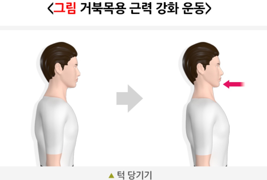 거북목 자세