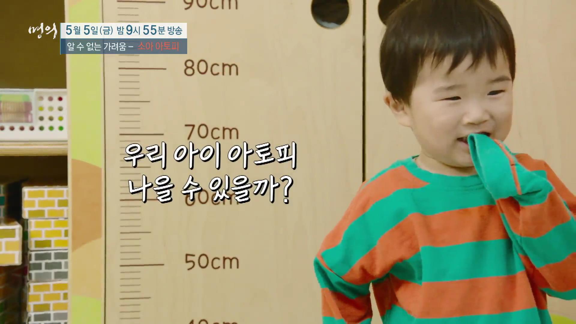 명의 어린이 소아 아토피 피부염 스테로이드 효과 및 부작용 완치 치료제 신약 비용 방법