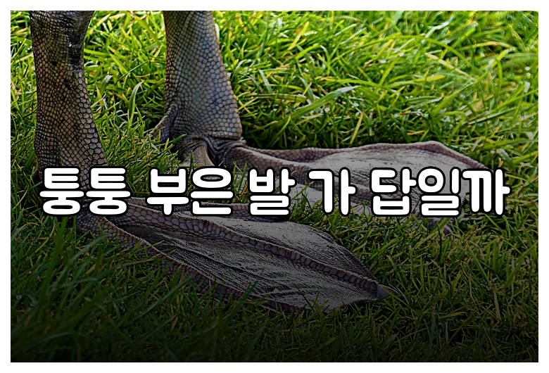 퉁퉁 부은 발 가 답일까