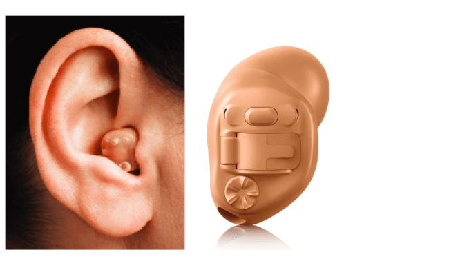 귓속형 보청기 착용 사진
