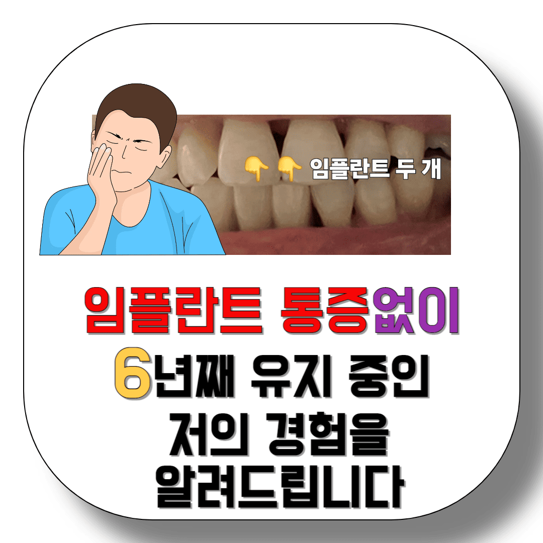 임플란트-통증없이-6년째-유지-중인-저의-관리-방법을-알려드립니다